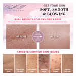 Load image into Gallery viewer, Double-Layered Exfoliating Mitt - Seraphic Skincare