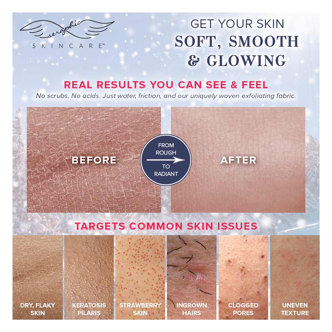 Winter Glow Exfoliating Mitt