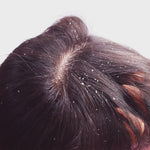 Load and play video in Gallery viewer, Exfoliating Scalp Massager
