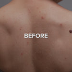 Charger et lire la vidéo dans la visionneuse de galerie, Exfoliant pour le dos de qualité supérieure 
