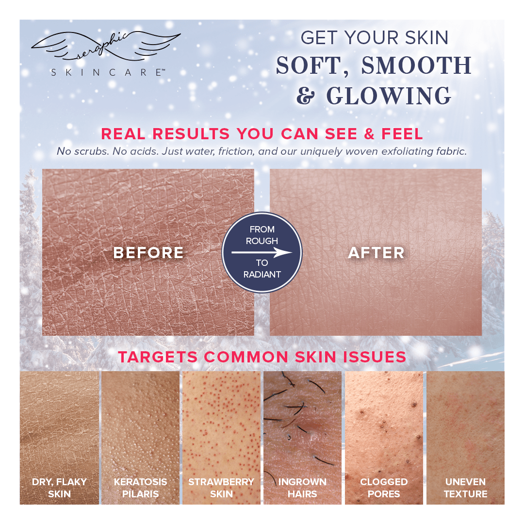 Winter Glow Exfoliating Mitt - Seraphic Skincare